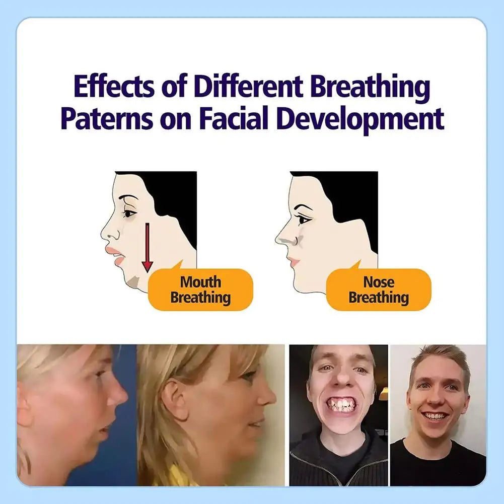 Oral Breathing Correction Patch – Anti Mouth-Breathing Sleep Aid