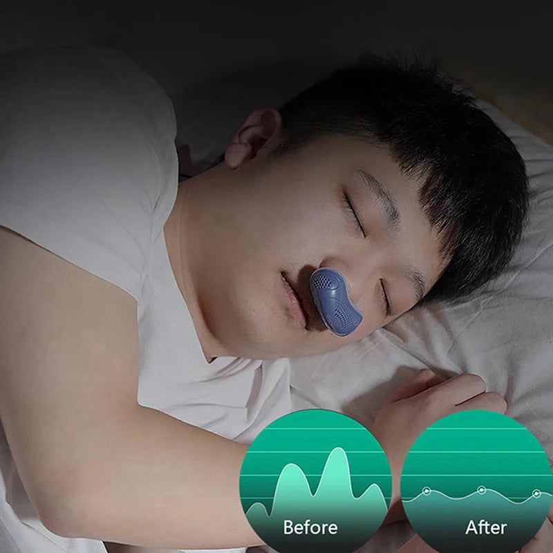 Micro Electric CPAP Anti-Snoring Device