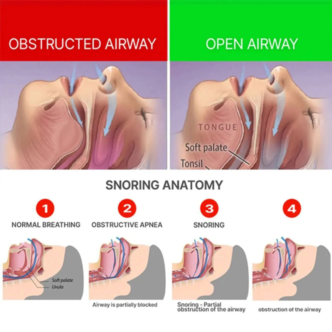 Anti-Snoring & Bruxism Mouth Guard Device